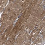 HSPB8 Antibody in Immunohistochemistry (Paraffin) (IHC (P))