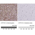 CYP11A1 Polyclonal Antibody
