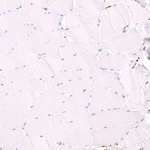 GLRA1 Antibody in Immunohistochemistry (Paraffin) (IHC (P))