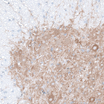 GLRA1 Polyclonal Antibody