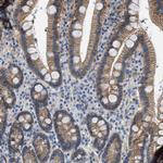 ORAI1 Antibody in Immunohistochemistry (Paraffin) (IHC (P))