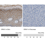 ORAI1 Antibody in Immunohistochemistry (Paraffin) (IHC (P))