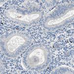 ORAI1 Antibody in Immunohistochemistry (Paraffin) (IHC (P))