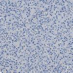 ORAI1 Antibody in Immunohistochemistry (Paraffin) (IHC (P))