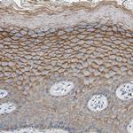 ORAI1 Antibody in Immunohistochemistry (Paraffin) (IHC (P))