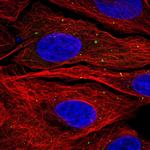 KCNQ5 Polyclonal Antibody