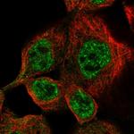 DUSP10 Polyclonal Antibody