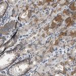 TRIP15 Polyclonal Antibody