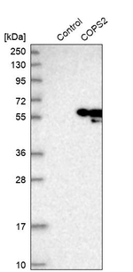 TRIP15 Antibody in Western Blot (WB)