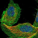 DCBLD2 Polyclonal Antibody