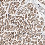 DCBLD2 Antibody in Immunohistochemistry (Paraffin) (IHC (P))