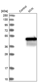 MVK Antibody in Western Blot (WB)
