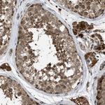 MELK Antibody in Immunohistochemistry (Paraffin) (IHC (P))