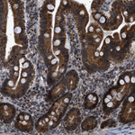MELK Antibody in Immunohistochemistry (Paraffin) (IHC (P))
