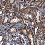 MELK Antibody in Immunohistochemistry (Paraffin) (IHC (P))
