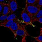 Chromogranin A Polyclonal Antibody