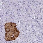 Chromogranin A Antibody in Immunohistochemistry (Paraffin) (IHC (P))