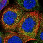 Cystatin B Antibody in Immunocytochemistry (ICC/IF)