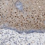 Cystatin B Antibody in Immunohistochemistry (Paraffin) (IHC (P))