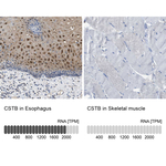 Cystatin B Antibody in Immunohistochemistry (Paraffin) (IHC (P))