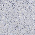 Cystatin B Antibody in Immunohistochemistry (Paraffin) (IHC (P))