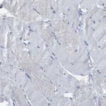 Cystatin B Antibody in Immunohistochemistry (Paraffin) (IHC (P))
