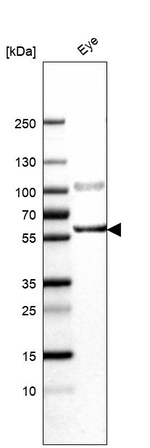 ENTPD2 Antibody in Western Blot (WB)