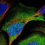 PSMC5 Polyclonal Antibody