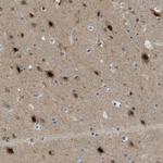 PSMC5 Antibody in Immunohistochemistry (Paraffin) (IHC (P))