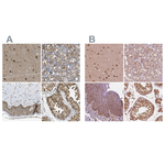PSMC5 Antibody in Immunohistochemistry (Paraffin) (IHC (P))
