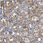 PSMC5 Antibody in Immunohistochemistry (Paraffin) (IHC (P))