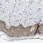 PSMC5 Antibody in Immunohistochemistry (Paraffin) (IHC (P))