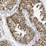 PSMC5 Antibody in Immunohistochemistry (Paraffin) (IHC (P))