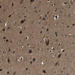 YARS Antibody in Immunohistochemistry (Paraffin) (IHC (P))