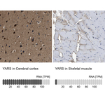 YARS Antibody in Immunohistochemistry (Paraffin) (IHC (P))