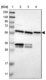 YARS Antibody in Western Blot (WB)