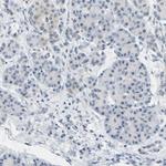 BAG1 Antibody in Immunohistochemistry (Paraffin) (IHC (P))