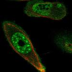 DRAK1 Polyclonal Antibody