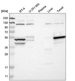 DRAK1 Antibody in Western Blot (WB)