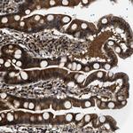 TRIP15 Polyclonal Antibody