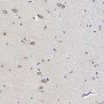 NUP35 Polyclonal Antibody