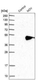 NOV Antibody in Western Blot (WB)