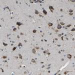 EMAP II Antibody in Immunohistochemistry (Paraffin) (IHC (P))