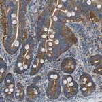 EMAP II Antibody in Immunohistochemistry (Paraffin) (IHC (P))