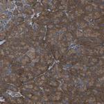 EMAP II Antibody in Immunohistochemistry (Paraffin) (IHC (P))