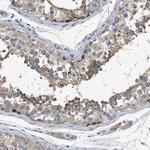 LGP2 Antibody in Immunohistochemistry (Paraffin) (IHC (P))