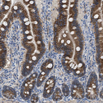 LGP2 Antibody in Immunohistochemistry (Paraffin) (IHC (P))