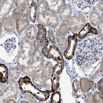 LGP2 Polyclonal Antibody