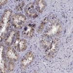 Angiopoietin 1 Antibody in Immunohistochemistry (Paraffin) (IHC (P))