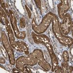 CIDEC Polyclonal Antibody
